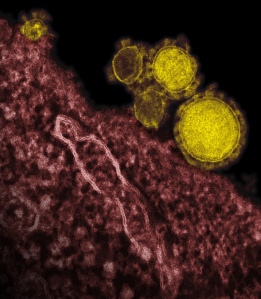 Transmission Electron Micrograph of MERS-CoV. Credit: NIAID