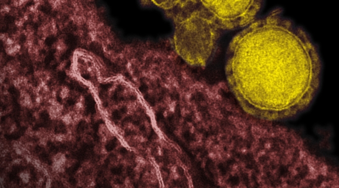 MERS-CoV – Will the time-bomb explode?
